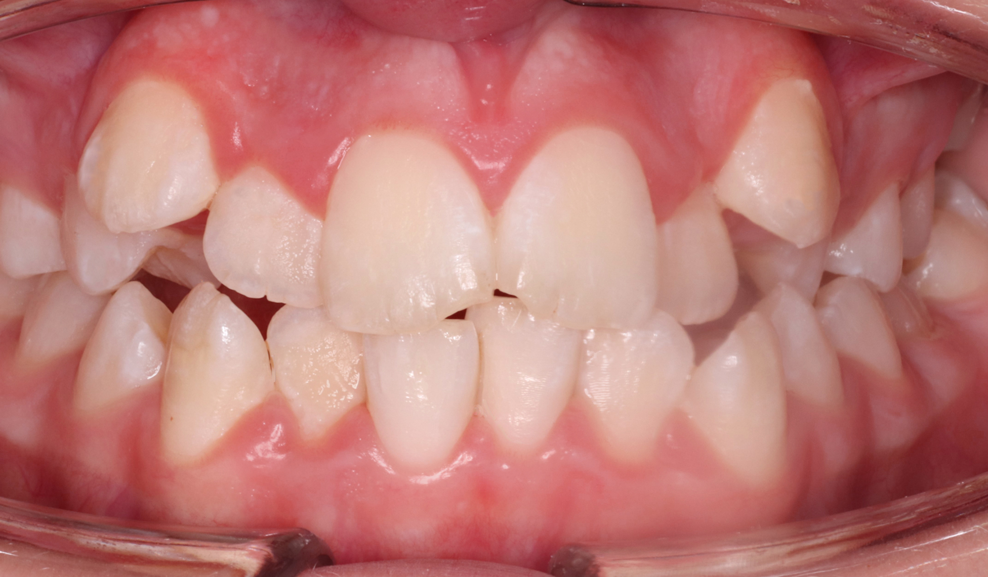 Чем удивить ортодонтического пациента?