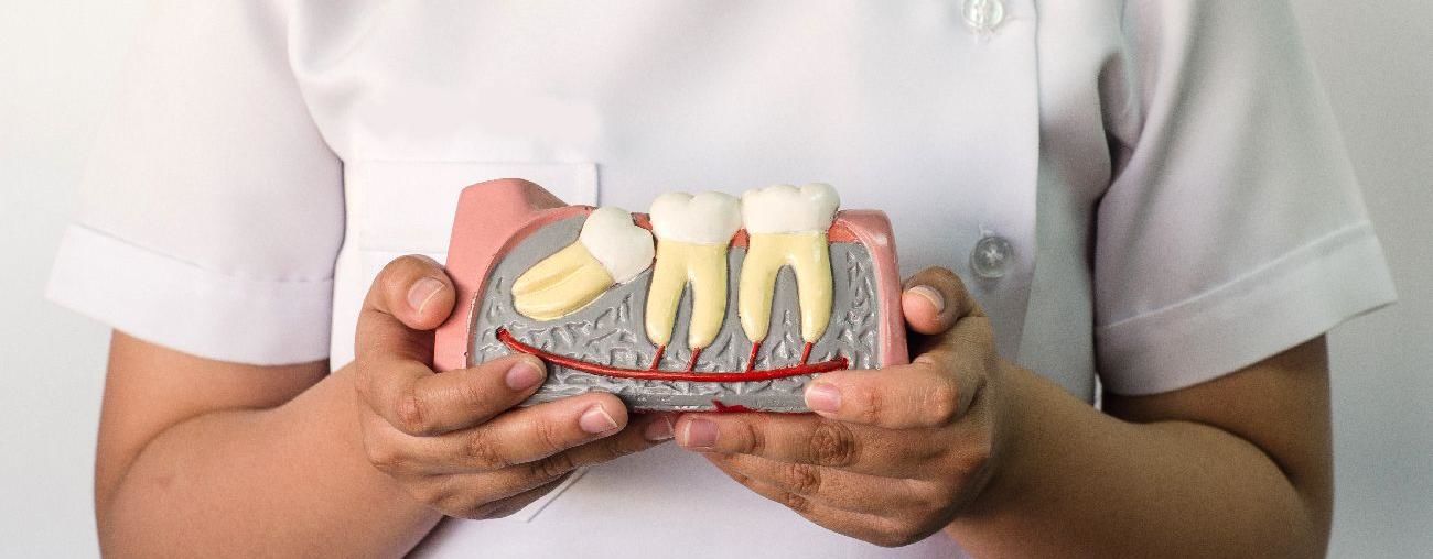Зубы мудрости. Удалять или нет?