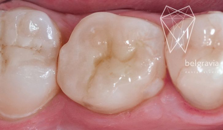Основные симптомы стоматологических заболеваний