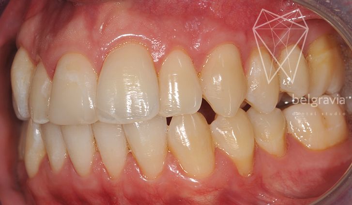 К чему снится как растут зубы — ТОП-35 значений