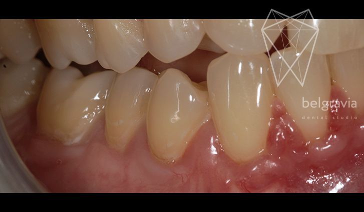 Стоматология хирургическое лечение зубов thumbnail