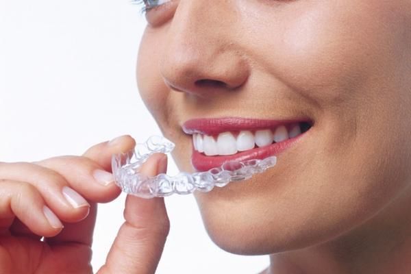 Ортодонтические системы Star Smile и Invisalign в Дентал Белгравия 