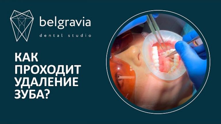 Как проходит удаление зуба в Belgravia Dental Studio